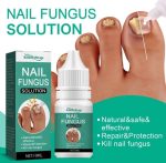 Fast Nail Fungal Treatments Nail Repair Essences Serum Care Treatments Foot Nail Fungus Removal Gel Paronychia Onychomycosis