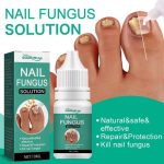 Fast Nail Fungal Treatments Nail Repair Essences Serum Care Treatments Foot Nail Fungus Removal Gel Paronychia Onychomycosis