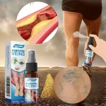 South Moon Varicose Veins Treatment Spray | Advanced Solution for Spider Veins, Leg Pain & Swelling Relief