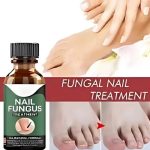 Fast Nail Fungal Treatments Oil Nail Repair Essences Serum Care Treatments Foot Nail Fungus Removal Gel Paronychia Onychomycosis - Image 3