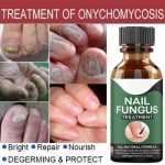 Fast Nail Fungal Treatments Oil Nail Repair Essences Serum Care Treatments Foot Nail Fungus Removal Gel Paronychia Onychomycosis - Image 5