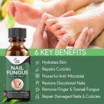 Fast Nail Fungal Treatments Oil Nail Repair Essences Serum Care Treatments Foot Nail Fungus Removal Gel Paronychia Onychomycosis - Image 6