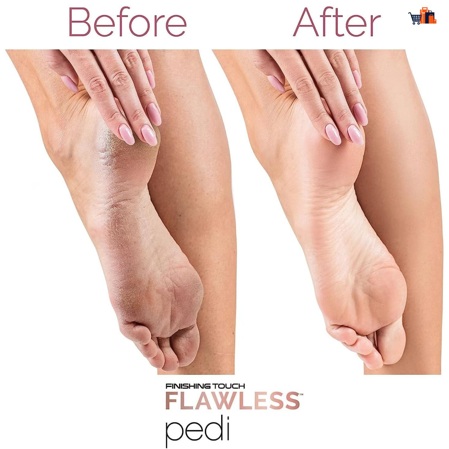 imgi_67_e165 Electric Foot Callus Remover for Feet - Foot Scrubber for Dead Skin - Rechargeable Pedicure Tool - Electronic Foot Filer Callus Remover - Feet Care for Removes Dry Hard and Dead Skin Ideal Gift - Image 1