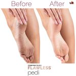 Electric Foot Callus Remover for Feet - Foot Scrubber for Dead Skin - Rechargeable Pedicure Tool - Electronic Foot Filer Callus Remover - Feet Care for Removes Dry Hard and Dead Skin Ideal Gift - Image 5