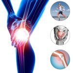 oin Support Knee Pad Breathable Non slip Power Lift Spring Force Knee Booster Tendon Brace Band 1 Pair - Image 3